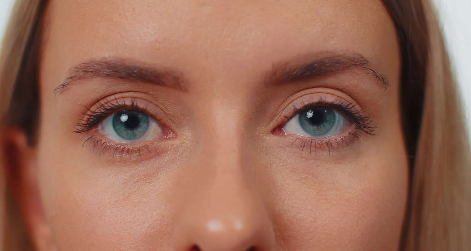 What Is Myokymia And When Does Treatment Become Necessary?