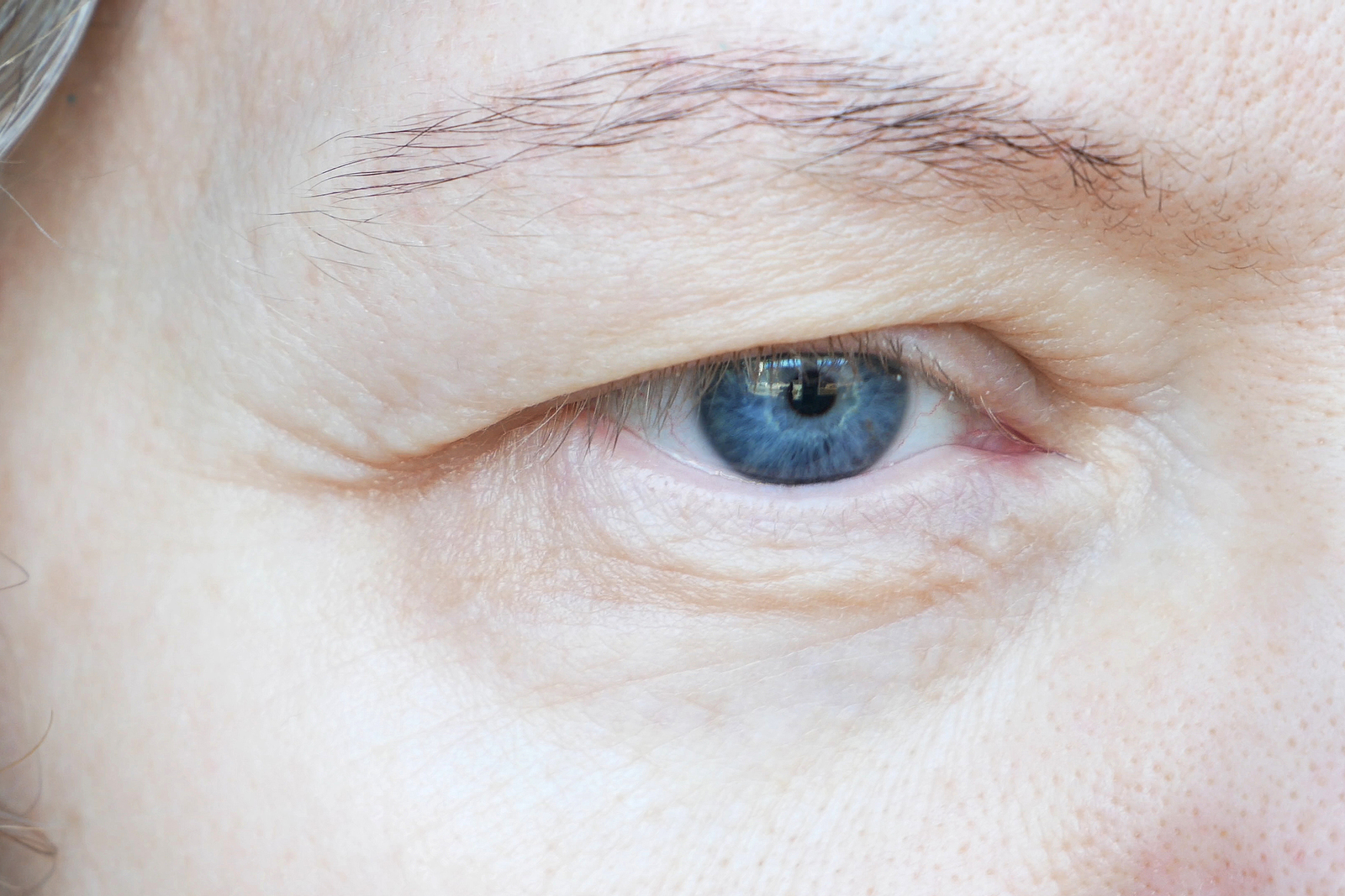 What Treatments Are Available For Different Types Of Ptosis?