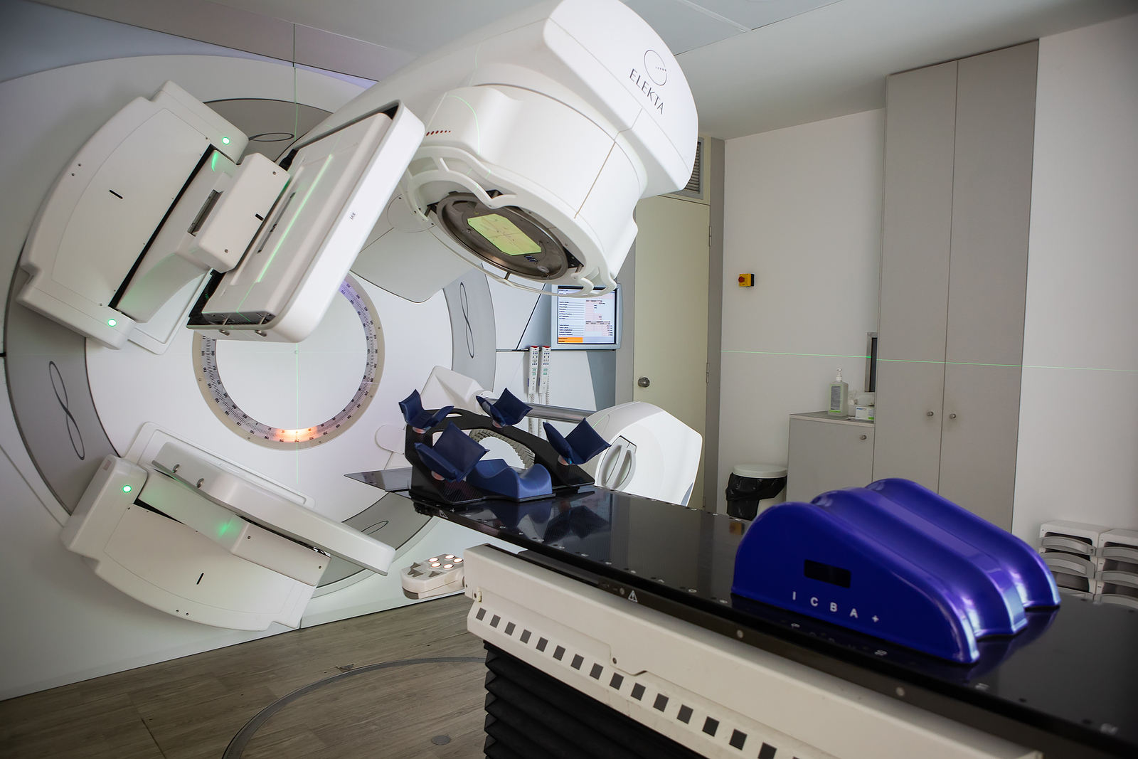How Radiotherapy Can Treat Severe Astrocytoma Cases