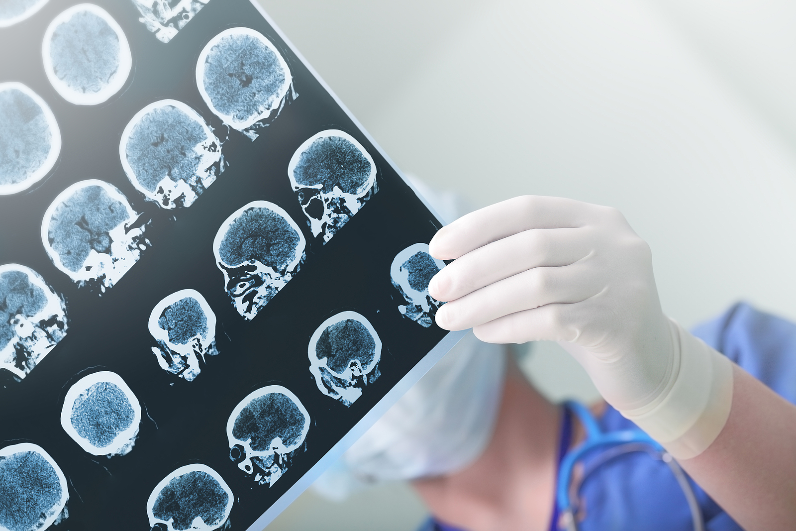 How Early Diagnosis Impacts On Brain Tumour Treatment