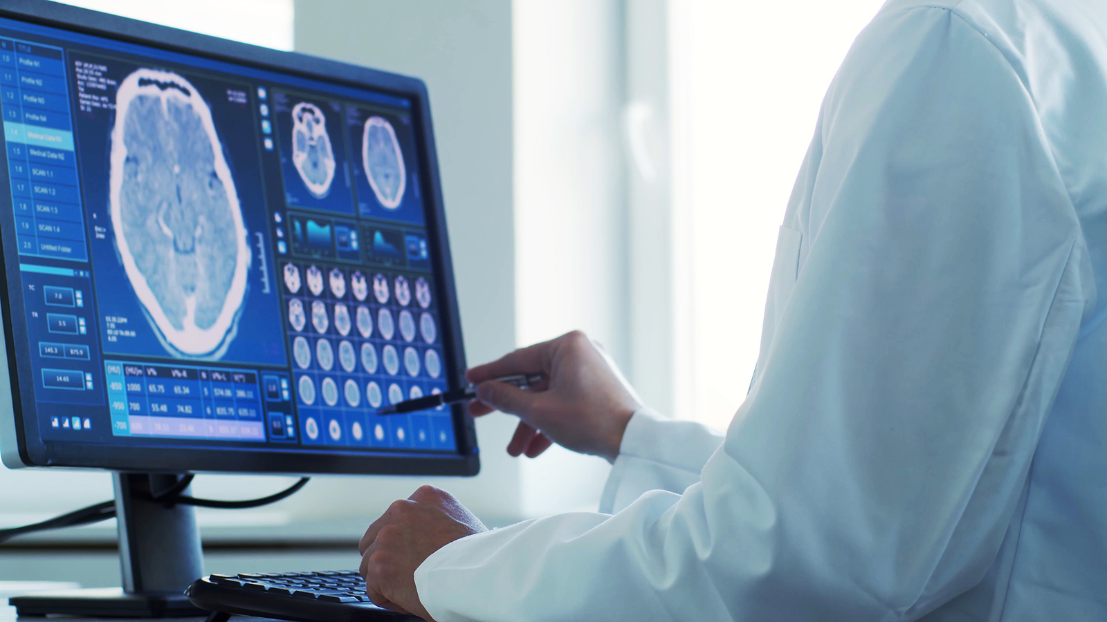 What Should You Expect When Recovering From Neurosurgery?