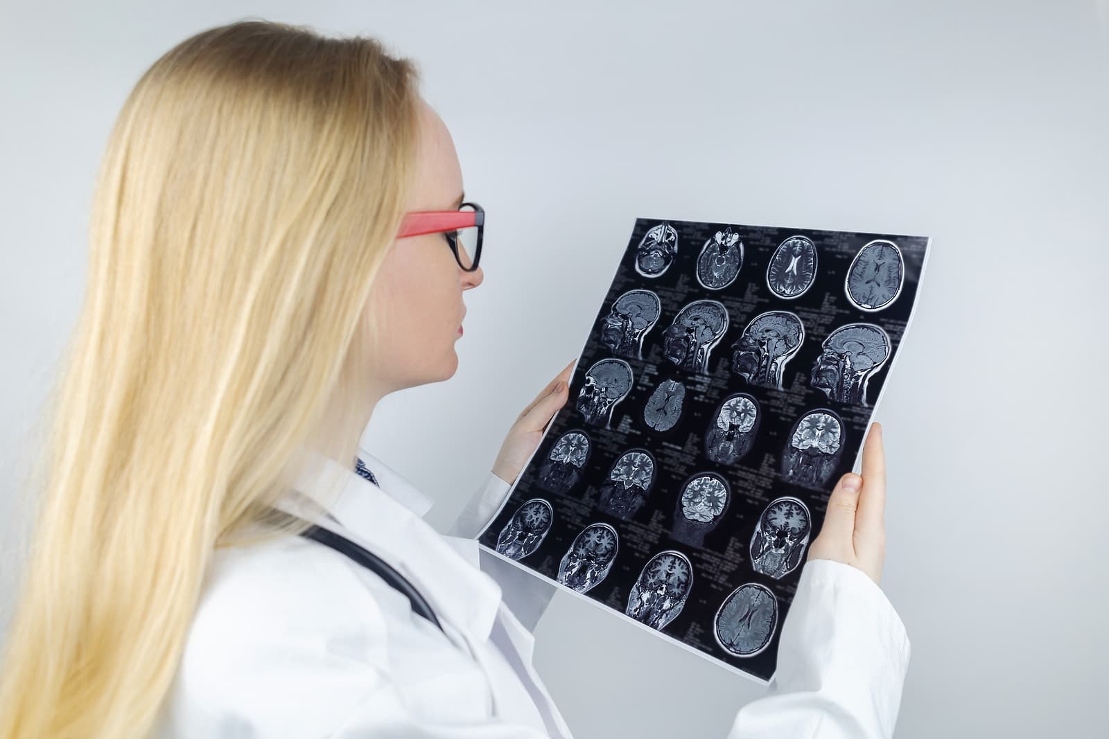 Why Trigeminal Neuralgia Is Frequently Misdiagnosed In Its Early Stages