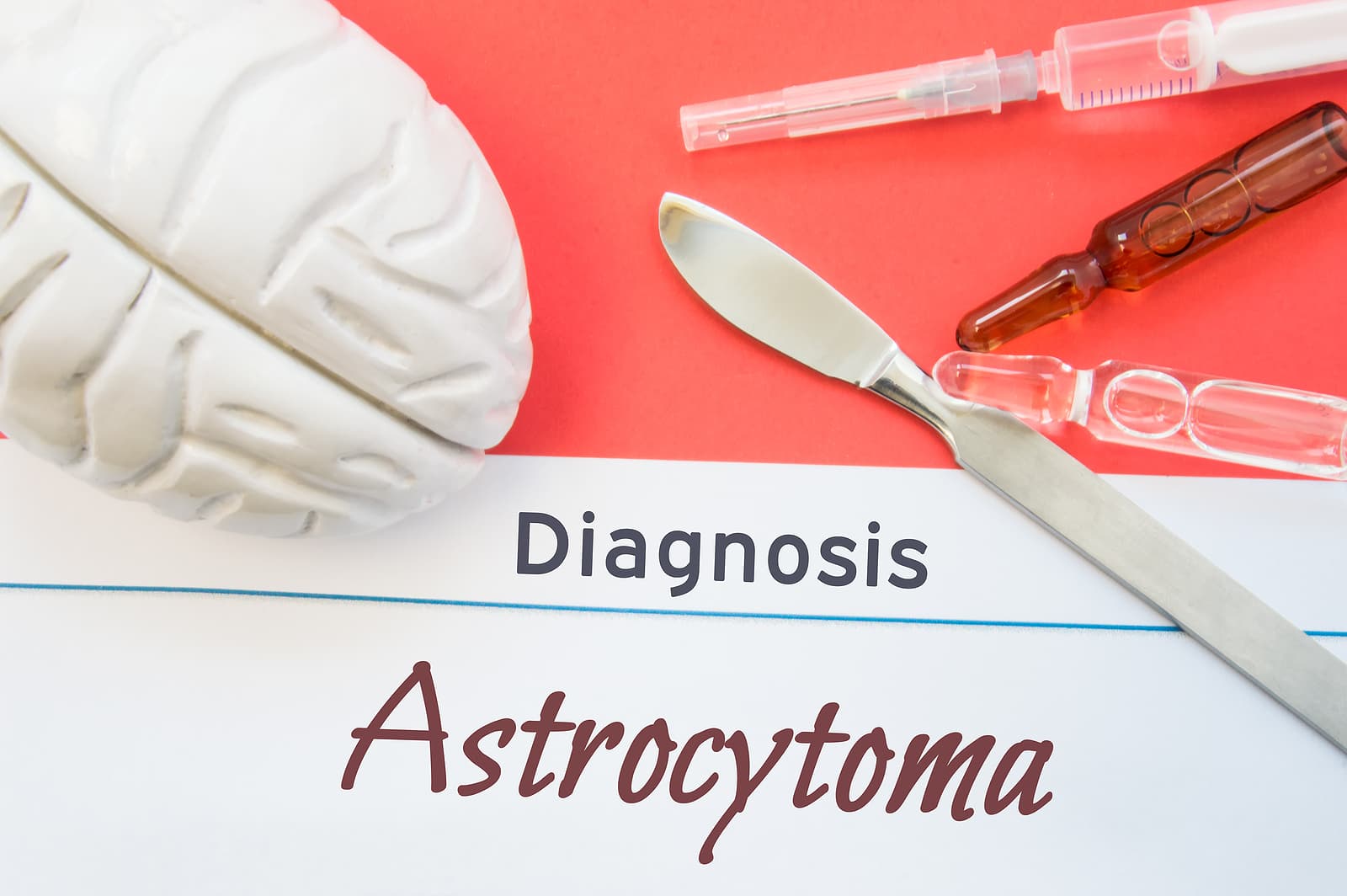 What Is An Astrocytoma And How Is It Diagnosed?