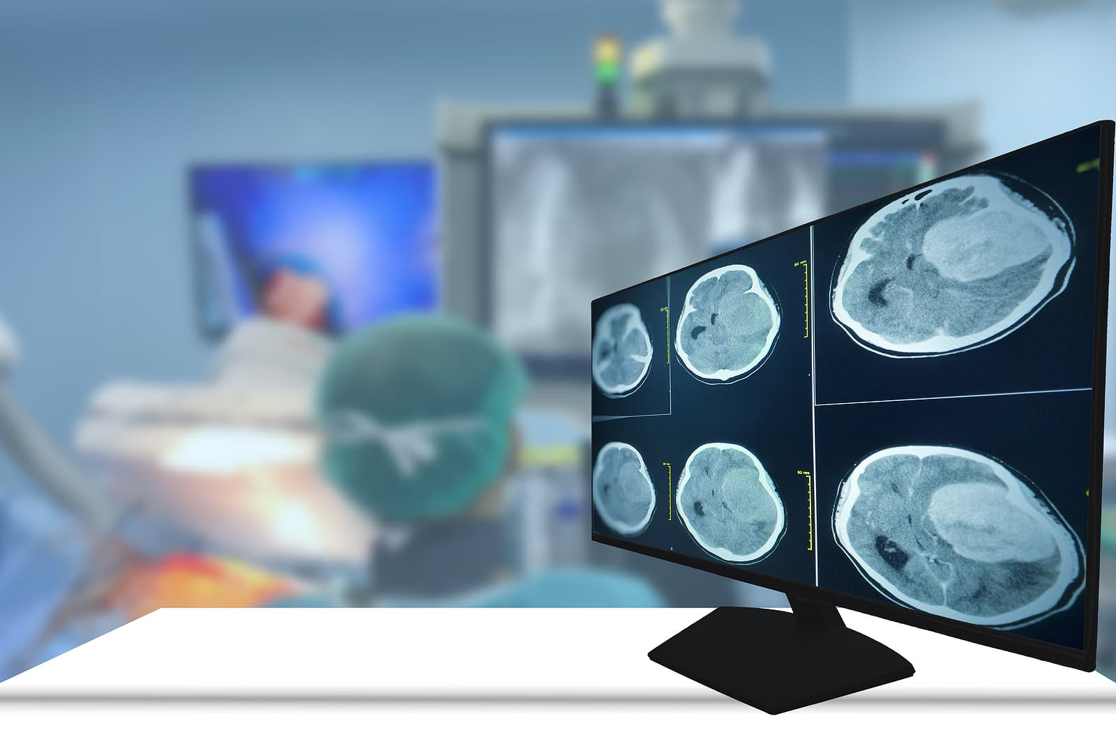 What New Treatments Are Being Investigated For Glioblastoma?