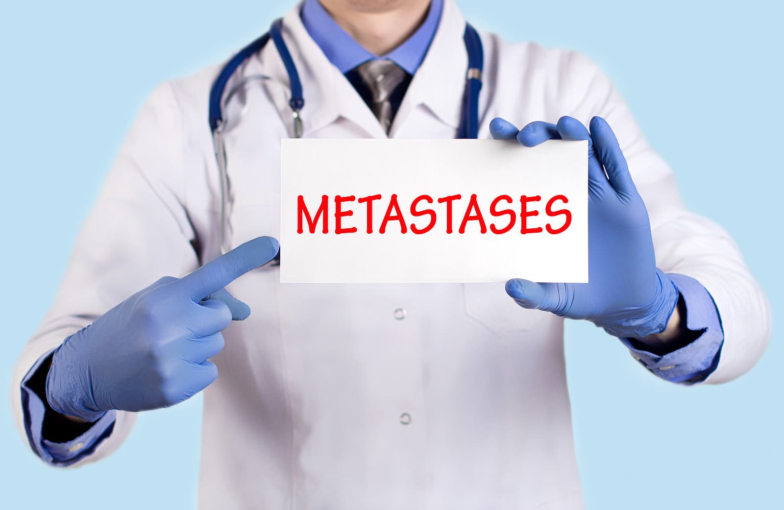 When Is Stereotactic Radiosurgery Used For Brain Metastases?
